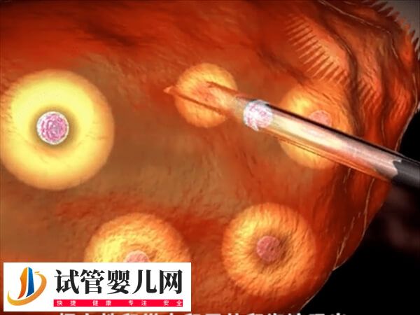 52歲女性絕經能不能做試管嬰兒