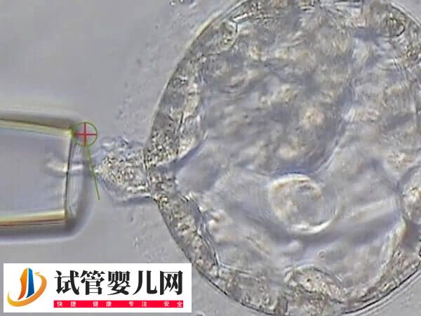 隔了3天卵泡才長了1mm正不正常(圖2)